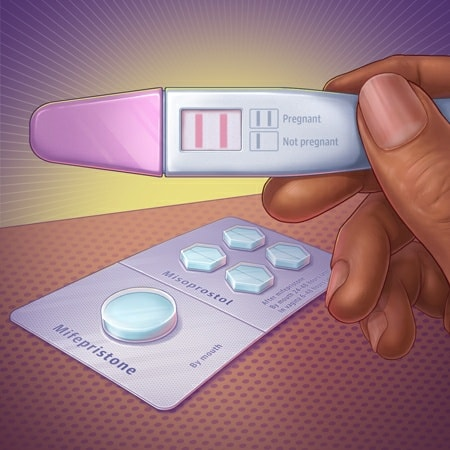 Abortion Pills in Al Madam, Sharjah